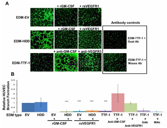 血管生成--甲狀腺轉錄因子-1（TTG-1）影響肺癌細胞血管生成