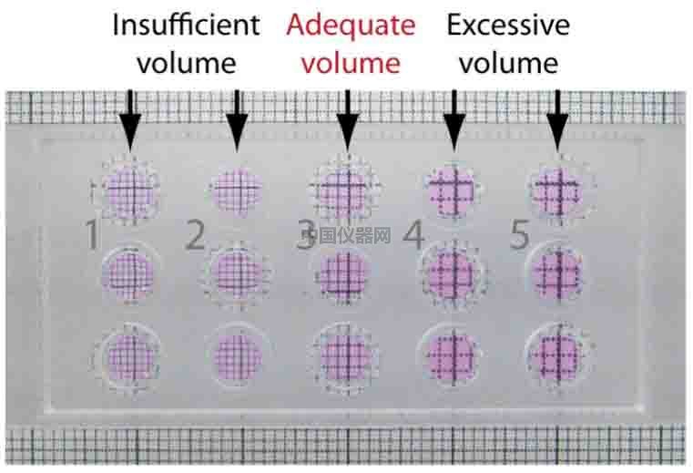 血管生成--甲狀腺轉錄因子-1（TTG-1）影響肺癌細胞血管生成